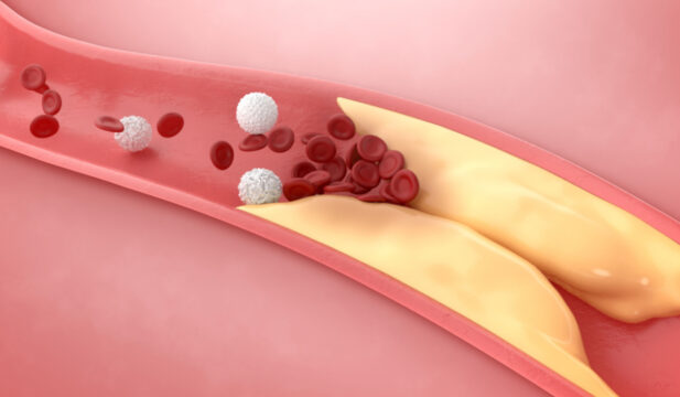 pollenza-profilo-lipidico-farmacia