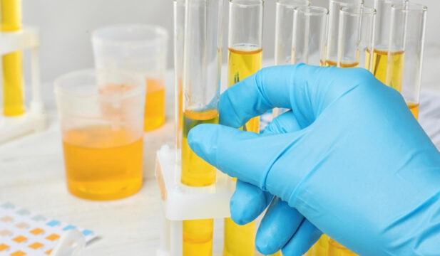 pollenza-urine-analisi-farmacia